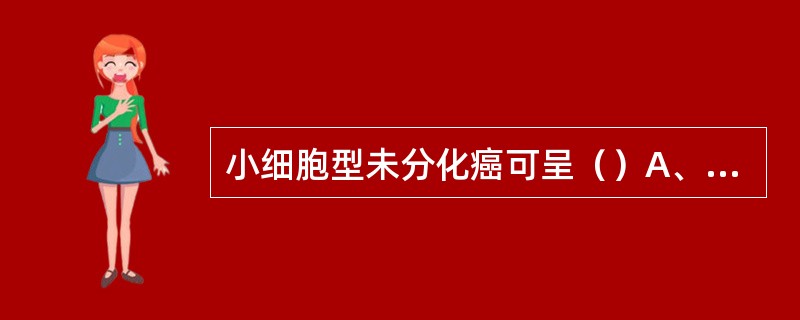 小细胞型未分化癌可呈（）A、镶嵌状结构B、桑葚状结构C、蝌蚪状癌细胞D、纤维状