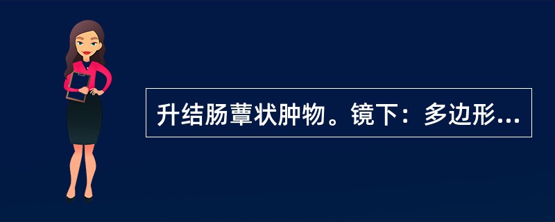 升结肠蕈状肿物。镜下：多边形及柱状上皮细胞呈巢状及宽索状排列或形成片块，细胞异型