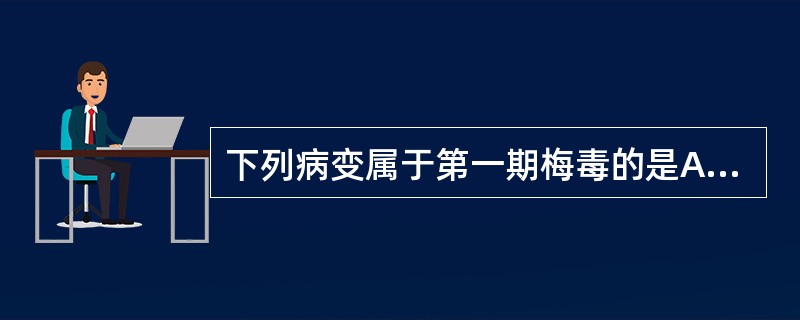 下列病变属于第一期梅毒的是A、梅毒疹B、梅毒树胶样肿C、马鞍鼻D、硬性下疳E、麻