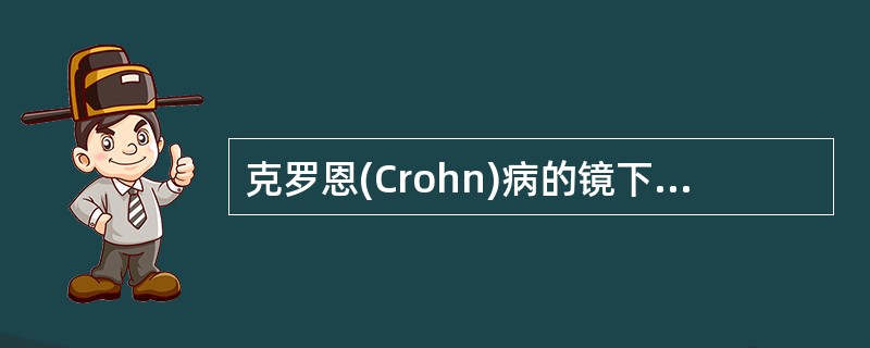 克罗恩(Crohn)病的镜下病变不包括A、肠壁全层炎细胞浸润B、黏膜下层高度水肿