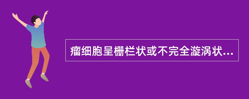 瘤细胞呈栅栏状或不完全漩涡状排列(Verocay小体)的肿瘤是A、神经鞘瘤B、平