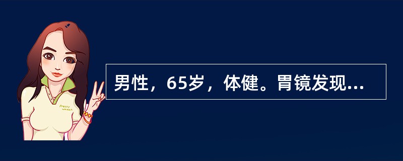 男性，65岁，体健。胃镜发现胃窦黏膜上有一约2cm盘状隆起病灶，色暗红，易出血。