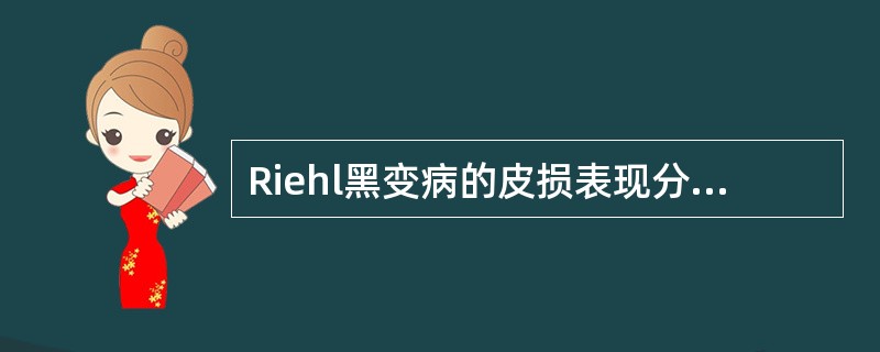 Riehl黑变病的皮损表现分为A、水肿期£­色素沉着期£­消退期B、炎症期£­色