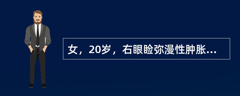 女，20岁，右眼睑弥漫性肿胀、上睑下垂、眼球突出、视力下降。检查躯体皮肤可见牛奶