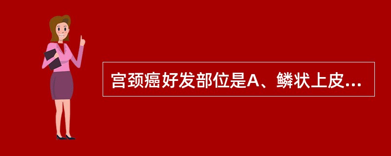 宫颈癌好发部位是A、鳞状上皮区B、柱状上皮区C、宫颈上皮移行带D、成熟鳞状上皮化