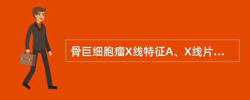 骨巨细胞瘤X线特征A、X线片示:骨端膨胀性溶骨性破坏B、X线片示:短骨膨胀，有蜂