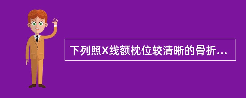 下列照X线额枕位较清晰的骨折是( )。A、颅顶骨折B、凹陷骨折C、颅前窝骨折D、