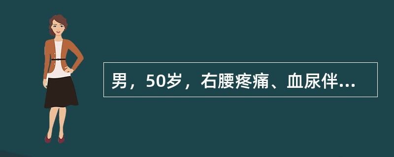 男，50岁，右腰疼痛、血尿伴低热3个月。查体发现右侧精索静脉曲张Ⅲ度，此患者的诊