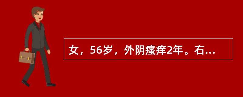 女，56岁，外阴瘙痒2年。右小阴唇见2cm大皮肤粗糙区，活检为Paget病，属于