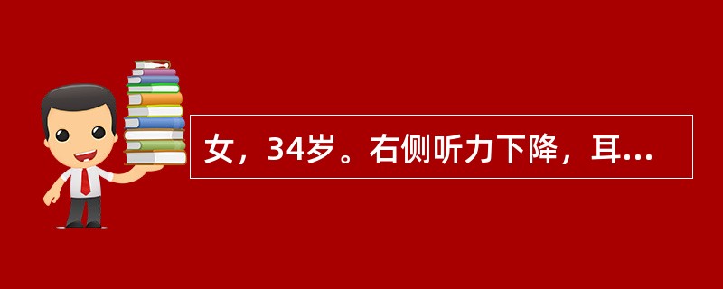 女，34岁。右侧听力下降，耳鸣2个月。MRI平扫及增强扫描如图示，最可能的诊断是