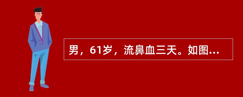 男，61岁，流鼻血三天。如图所示最可能的诊断为（）。