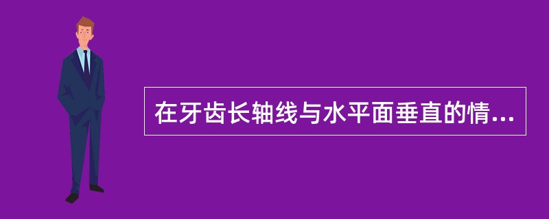 在牙齿长轴线与水平面垂直的情况下垂直杆与牙冠轴面最突点接触的连线叫做( )。A、