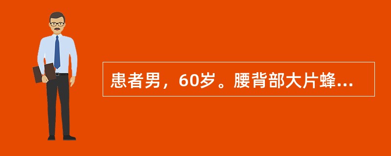 患者男，60岁。腰背部大片蜂窝组织炎。其主要的致病菌是A、大肠杆菌B、绿脓杆菌C