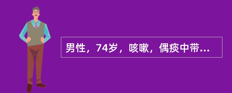 男性，74岁，咳嗽，偶痰中带血，胸痛近两个月，后前位示左肺门肿块影约3cm大小，