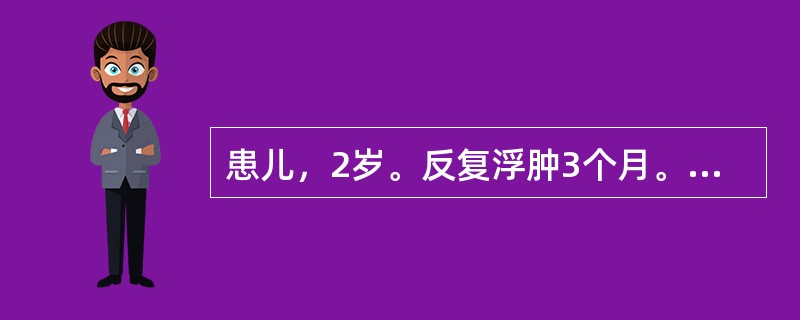 患儿，2岁。反复浮肿3个月。尿蛋白定量(£«£«£«)，镜检（£­），尿蛋白定量