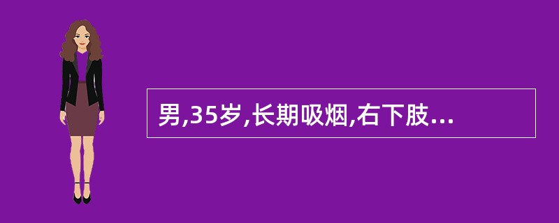 男,35岁,长期吸烟,右下肢反复发作静脉炎,并有间歇性跛行,最可能的诊断是()。