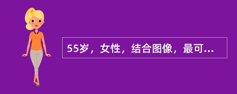 55岁，女性，结合图像，最可能的诊断是（）