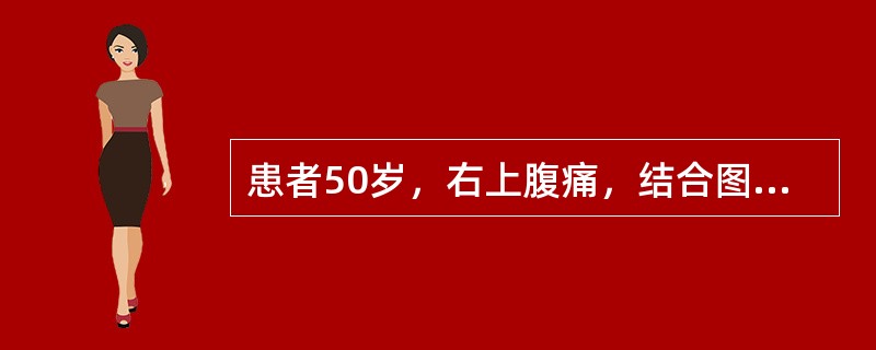 患者50岁，右上腹痛，结合图像，最可能的诊断是（）