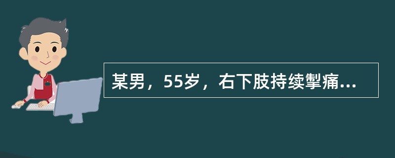 某男，55岁，右下肢持续掣痛2天，疼痛难忍，以右下肢疼痛沿股后向小腿后外侧放射为