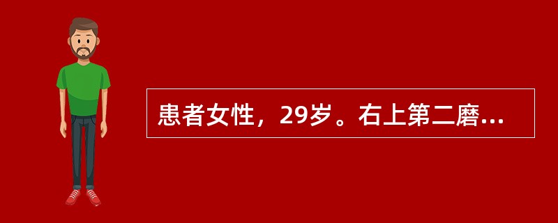 患者女性，29岁。右上第二磨牙残根，慢性根尖周炎。拔除腭侧根过程中，牙根突然消失