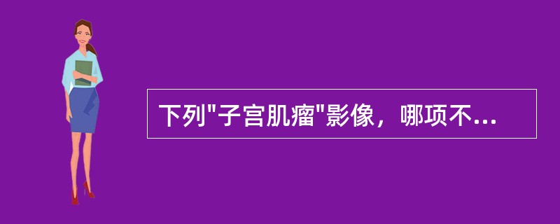 下列"子宫肌瘤"影像，哪项不对（）。