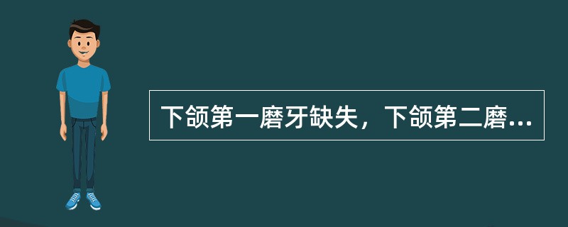 下颌第一磨牙缺失，下颌第二磨牙松动Ⅱ度，以下颌第二前磨牙、第二磨牙为基牙，活动义