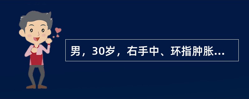 男，30岁，右手中、环指肿胀，疼痛，X片示中、环指近节指骨膨胀性骨吸收，夹杂钙化