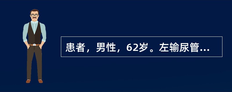 患者，男性，62岁。左输尿管上段结石伴肾积水5个月余，结石大小1.8cm&tim