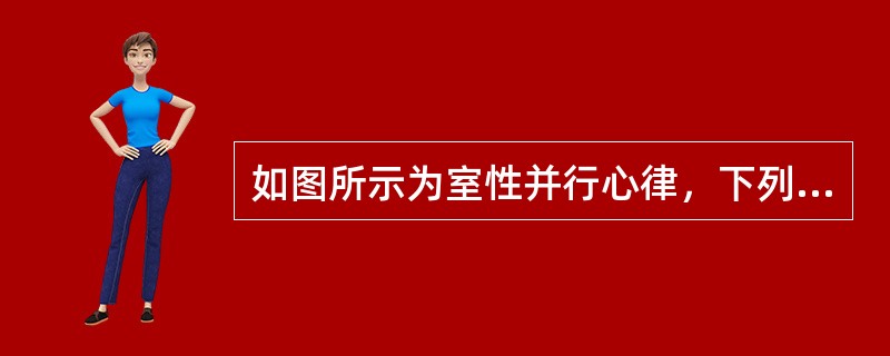 如图所示为室性并行心律，下列哪项不是室性并行心律的心电图特点()