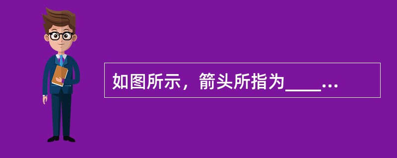 如图所示，箭头所指为__________________________。