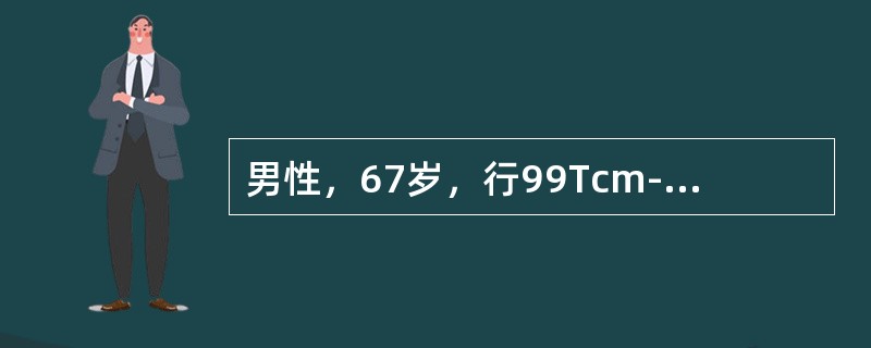 男性，67岁，行99Tcm-MIBI静息-硝酸甘油介入心肌显像如图，可能的诊断是