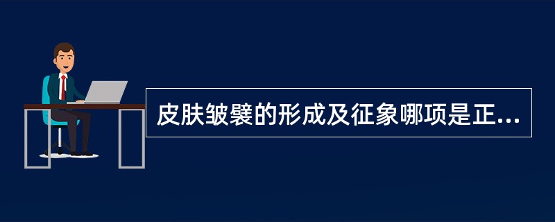 皮肤皱襞的形成及征象哪项是正确的()