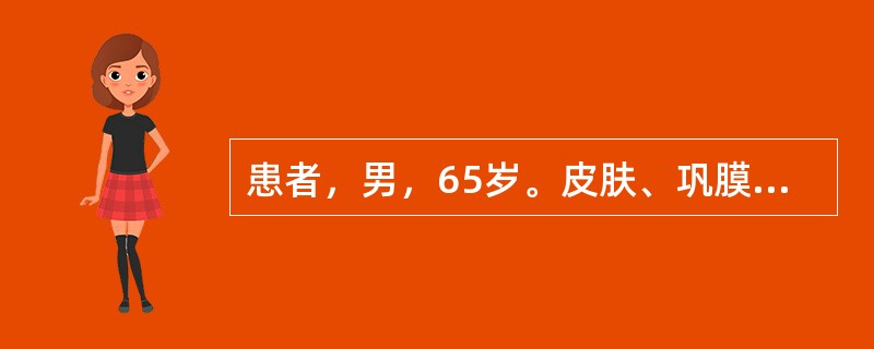 患者，男，65岁。皮肤、巩膜黄染进行性加重，大便持续变白，消瘦明显。应首先考虑的