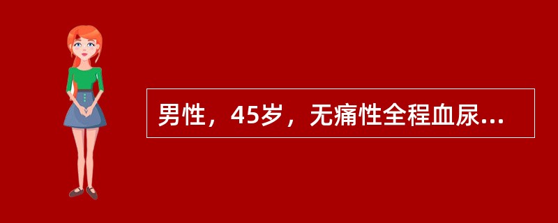 男性，45岁，无痛性全程血尿2个月，查体无异常。IVP：左肾上盏拉长、变窄，边缘