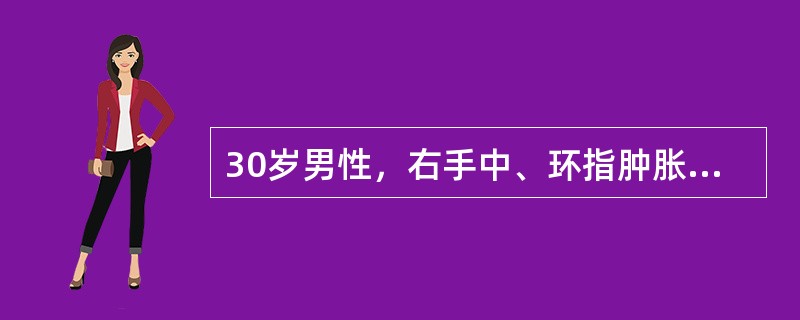 30岁男性，右手中、环指肿胀，疼痛一年，X线片示中、环指近节指骨膨胀性骨吸收，夹