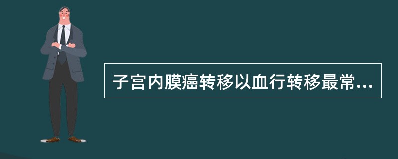 子宫内膜癌转移以血行转移最常见。