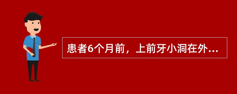 患者6个月前，上前牙小洞在外院复合树脂充填后一直有冷热痛。近1周疼痛加重，不敢咬