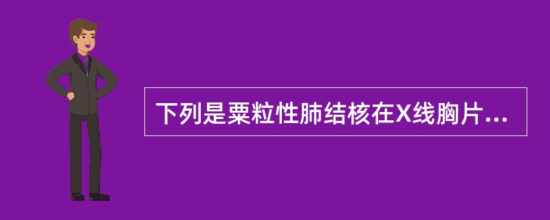 下列是粟粒性肺结核在X线胸片的特征的是（）。