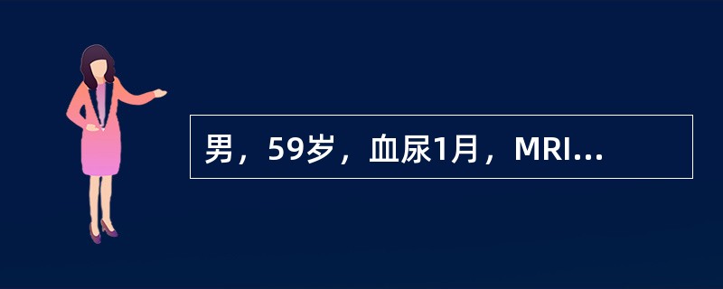 男，59岁，血尿1月，MRI检查如图所示。最可能的诊断是（）