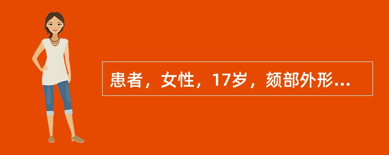 患者，女性，17岁，颏部外形发育不良，口唇闭合时口腔周围肌肉呈现紧张状态，面下1