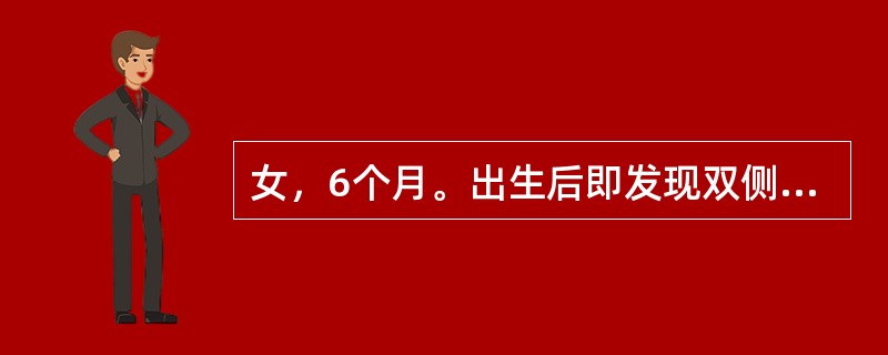 女，6个月。出生后即发现双侧上唇裂开。表现为双侧上唇至鼻底完全裂开。诊断为A、单