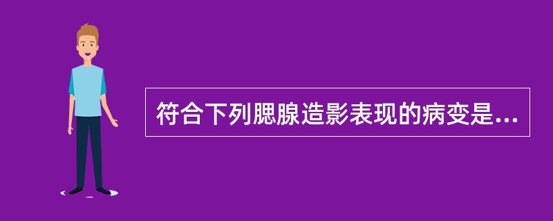 符合下列腮腺造影表现的病变是，主导管扩张呈脂肠状，分支导管扩张