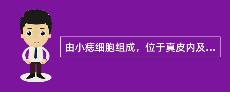 由小痣细胞组成，位于真皮内及其周围结缔组织中的是A、交界痣B、皮内痣C、复合痣D