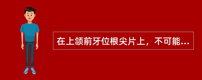 在上颌前牙位根尖片上，不可能看到的颌骨解剖标志是