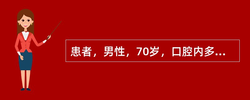 患者，男性，70岁，口腔内多数牙冷、热刺激酸痛1月余。4个月前曾因鼻咽癌接受颌面