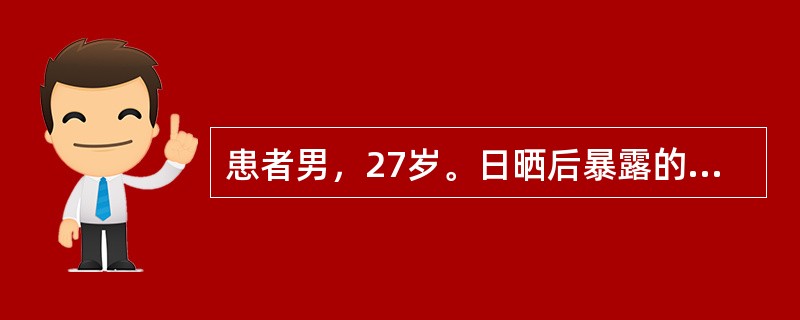 患者男，27岁。日晒后暴露的皮肤出现皮疹，对称性关节痛，查血小板下降，尿蛋白阳性