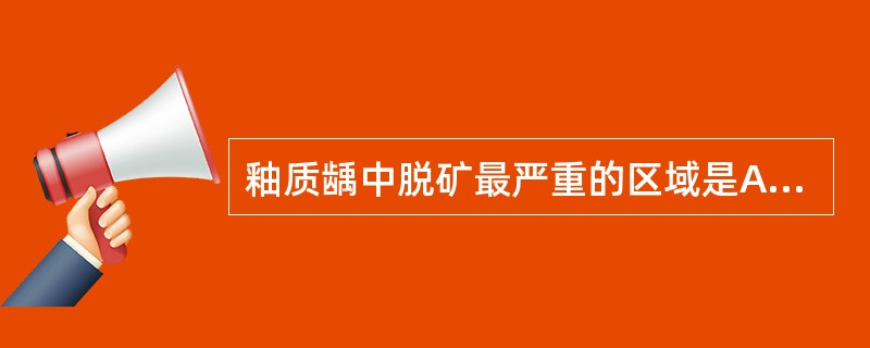 釉质龋中脱矿最严重的区域是A、透明层B、暗层C、病损体部D、表层E、脱矿层 -