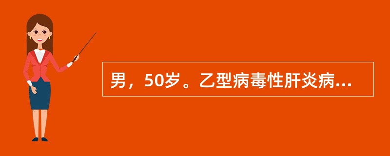 男，50岁。乙型病毒性肝炎病史30年，腹胀，乏力，双下肢水肿伴尿少1个月。B超检