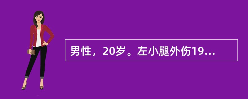 男性，20岁。左小腿外伤19小时就诊。查体：左小腿畸形，假关节活动，骨摩擦感，胫