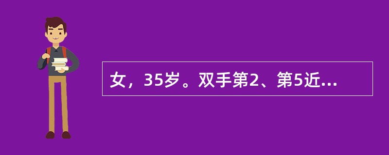 女，35岁。双手第2、第5近端指间关节和双腕关节肿痛3个月，双颞颌关节及颈椎疼痛